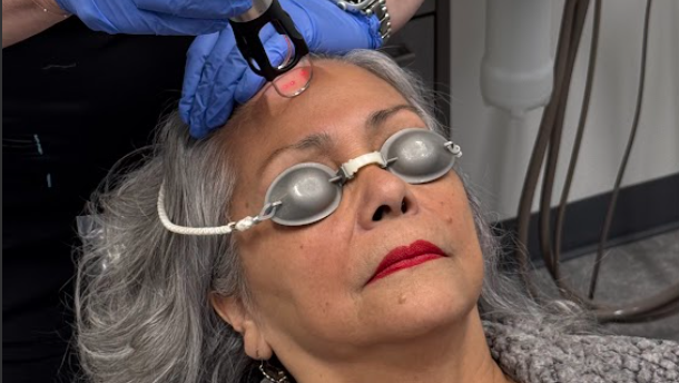 Client receiving CoolPeel CO2 laser facial treatment for skin rejuvenation at facial spa