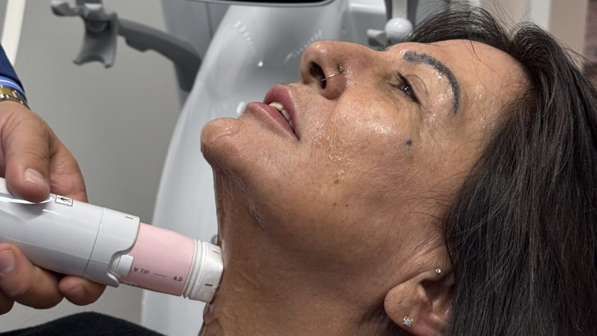 Everesse radiofrequency skin tightening treatment applied to client’s jawline for lifting and firming