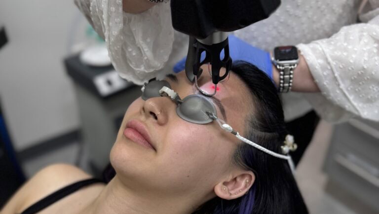 Client receiving CoolPeel™ CO₂ laser facial treatment for skin rejuvenation