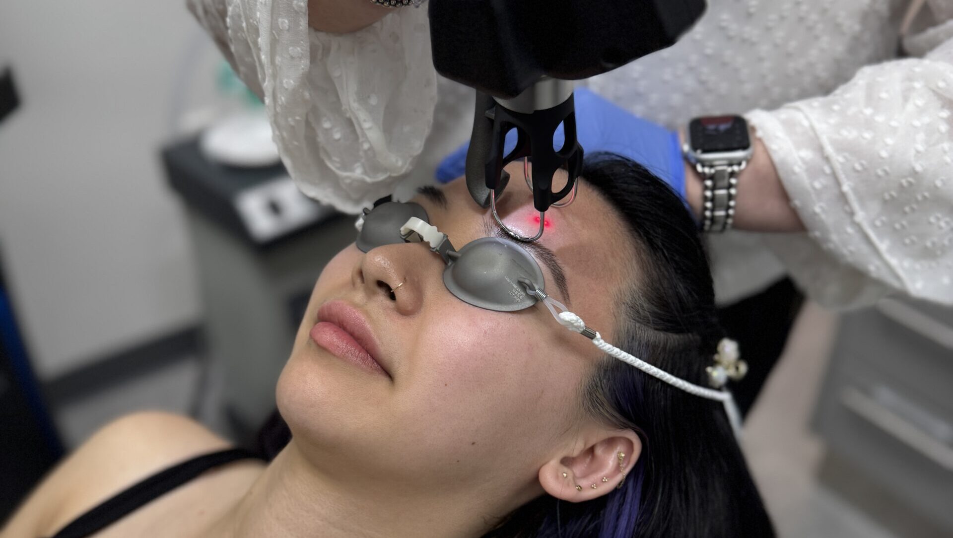 Client receiving CoolPeel™ CO₂ laser facial treatment for skin rejuvenation