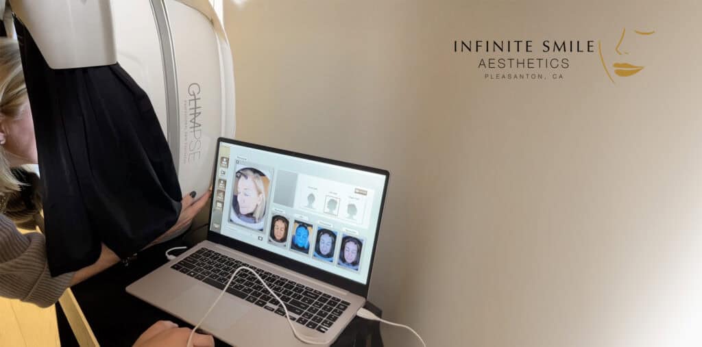 Glimpse Skin Analyzer device at Infinite Smile Aesthetics used for advanced skin evaluation.