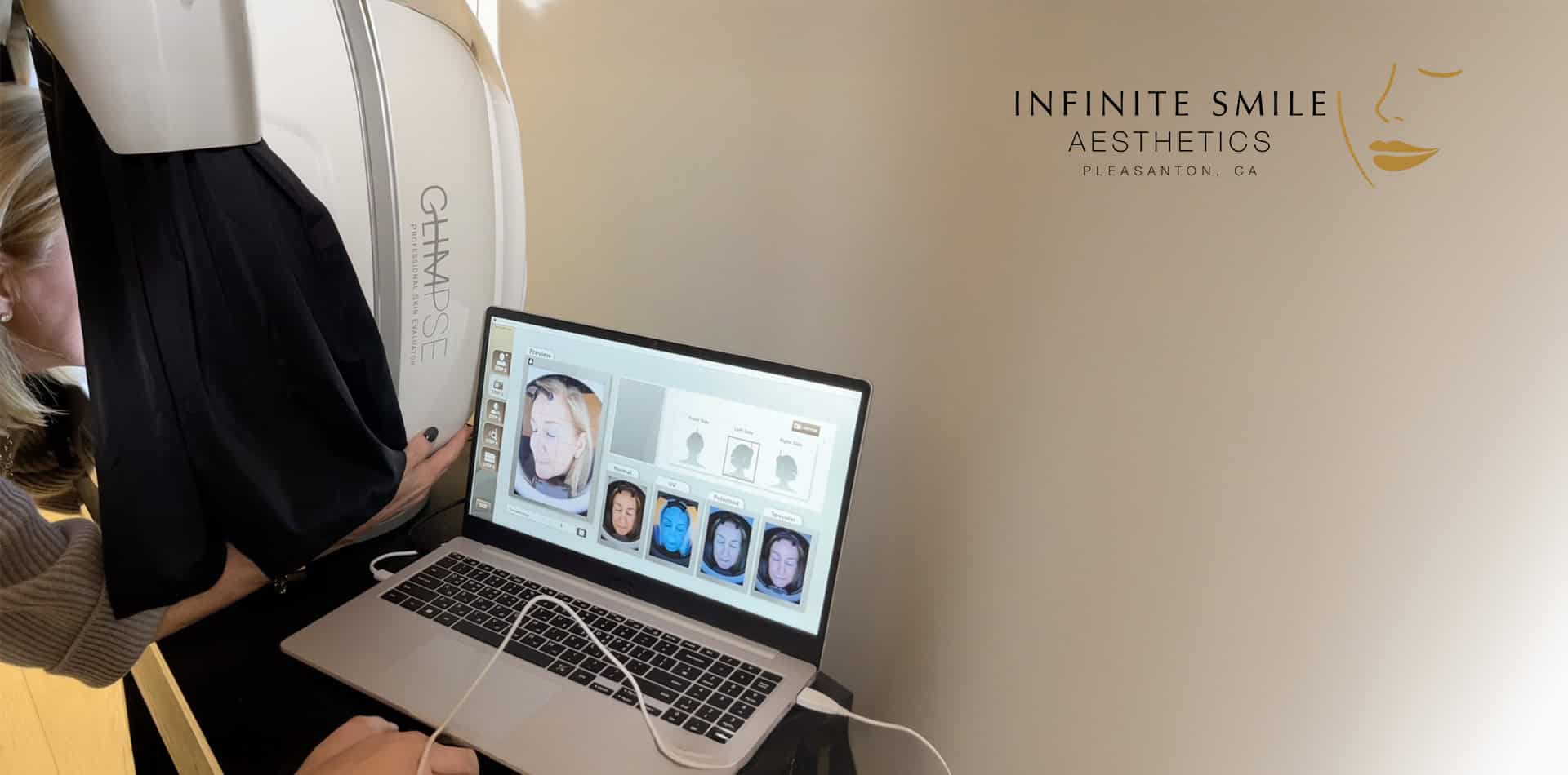 Glimpse Skin Analyzer device at Infinite Smile Aesthetics used for advanced skin evaluation.