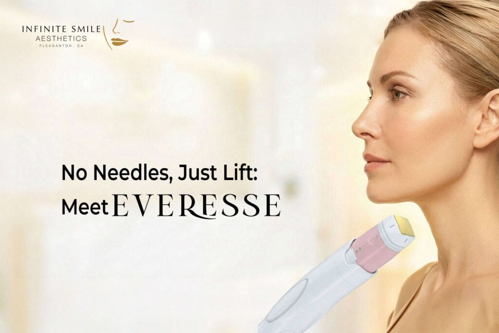 Promotional image for Infinite Smile Aesthetics in Pleasanton, CA, featuring the Everesse skin lifting treatment. The graphic shows a profile of a woman with a contoured jawline next to the Everesse applicator wand. Text reads: "No Needles, Just Lift: Meet Everesse."