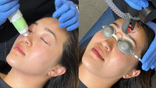 Jordan Everesse + CoolPeel Jordan Everesse + CoolPeel